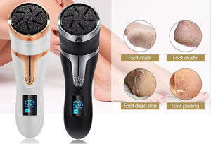 SoftSole  Callus And Dry Skin Remover - No More Rough, Dry Feet!